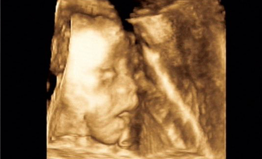 ����4Dд��