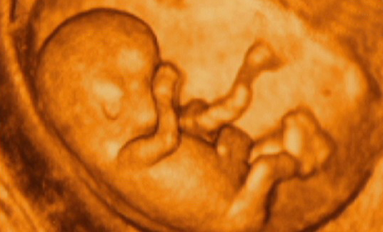 ����4Dд��