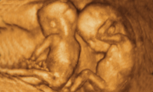 ����4Dд��