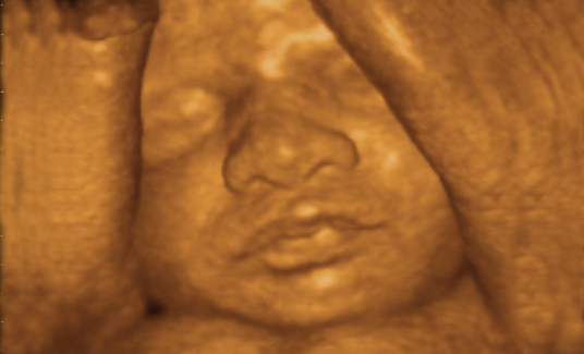 ����4Dд��