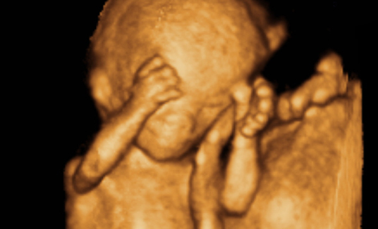 ����4Dд��